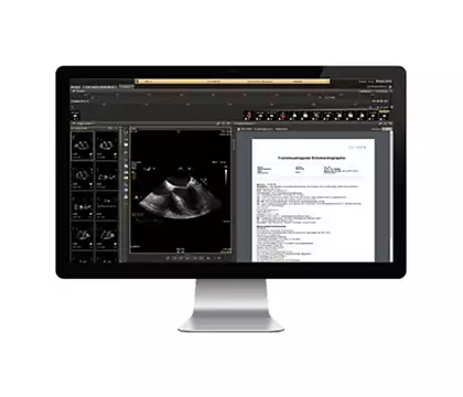 IntelliSpace Cardiovascular